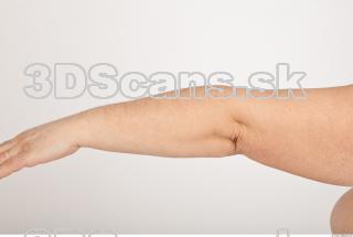 Photo reference of forearm 0001